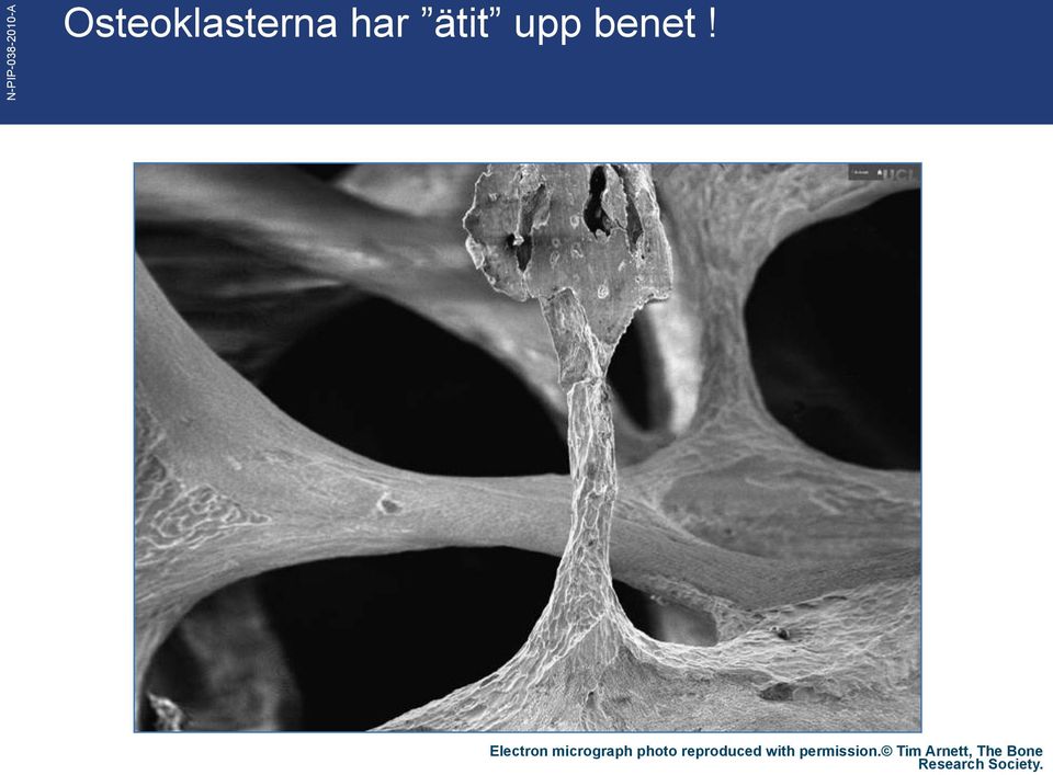 Electron micrograph photo