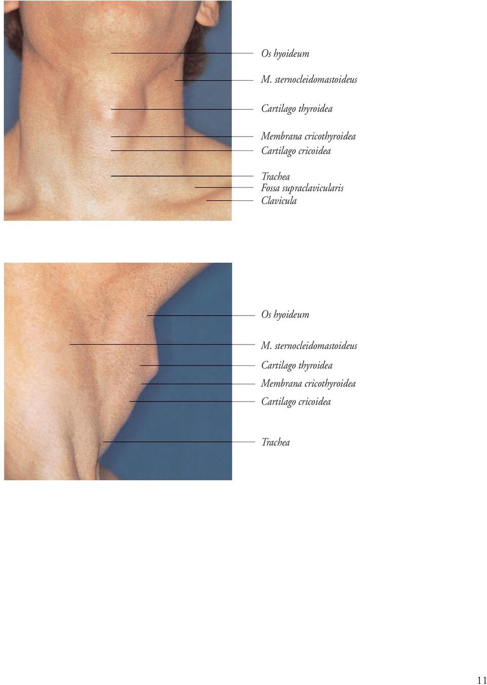 cricothyroidea Cartilago cricoidea Trachea Fossa