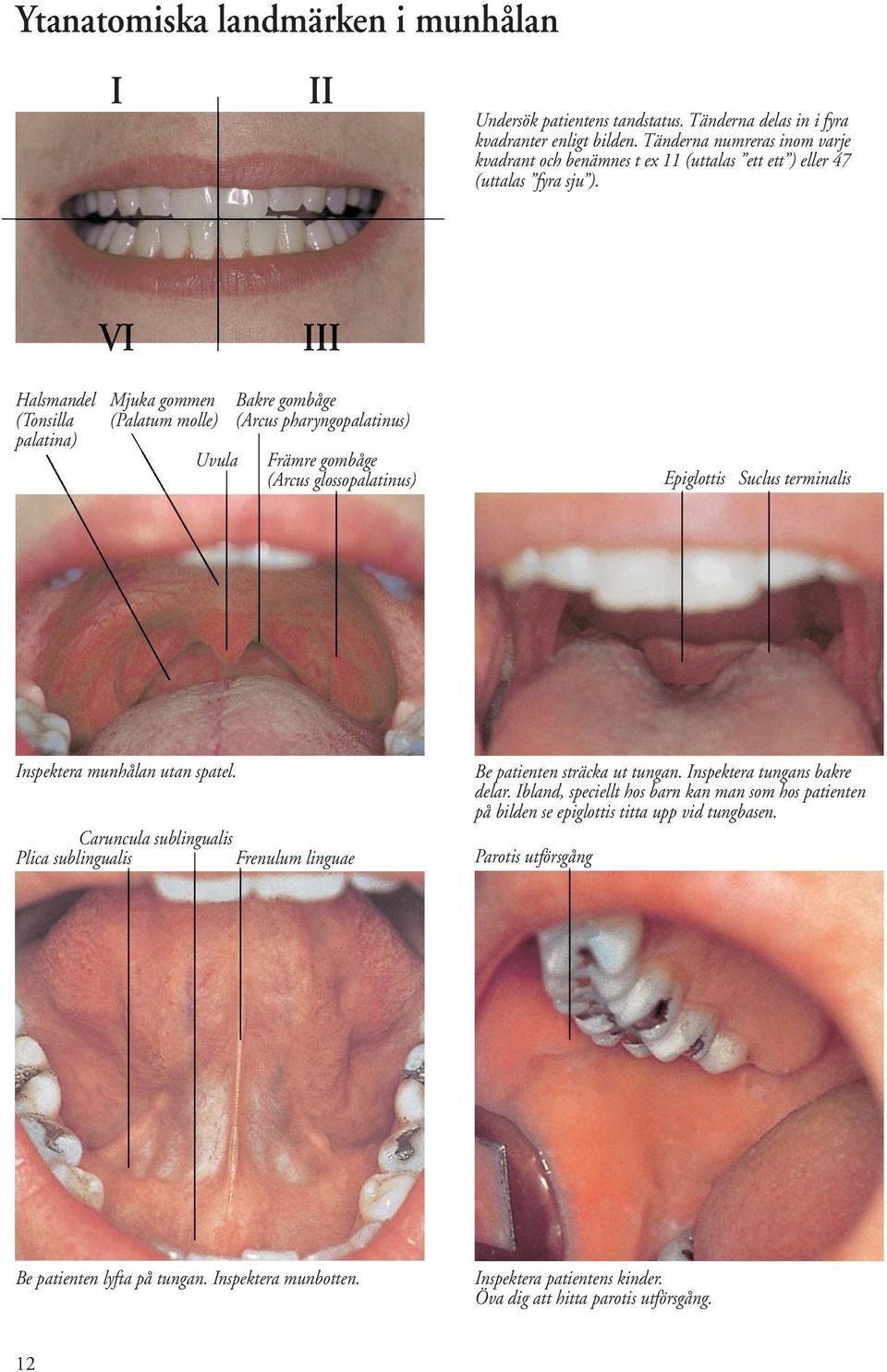 VI III Halsmandel Mjuka gommen Bakre gombåge (Tonsilla (Palatum molle) (Arcus pharyngopalatinus) palatina) Uvula Främre gombåge (Arcus glossopalatinus) Epiglottis Suclus terminalis Inspektera