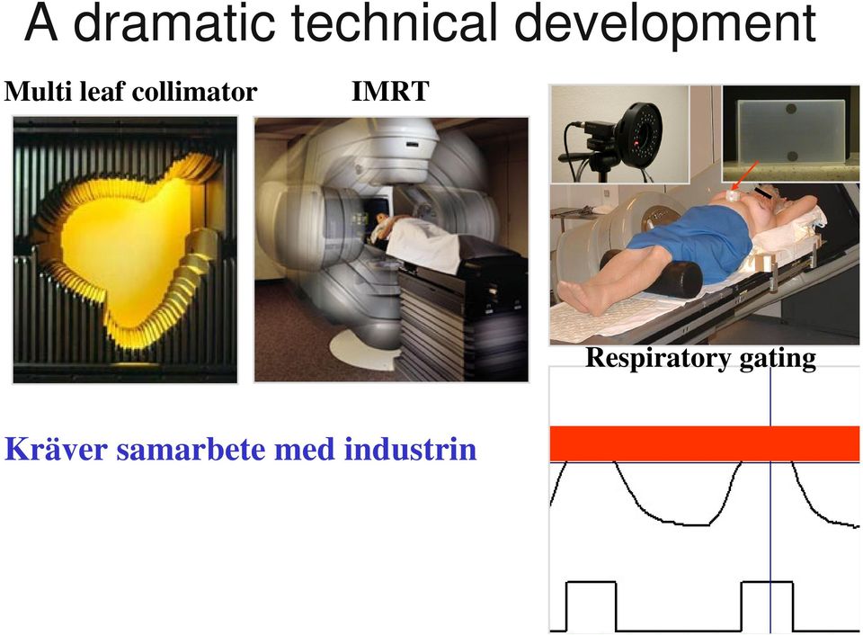 collimator IMRT Respiratory