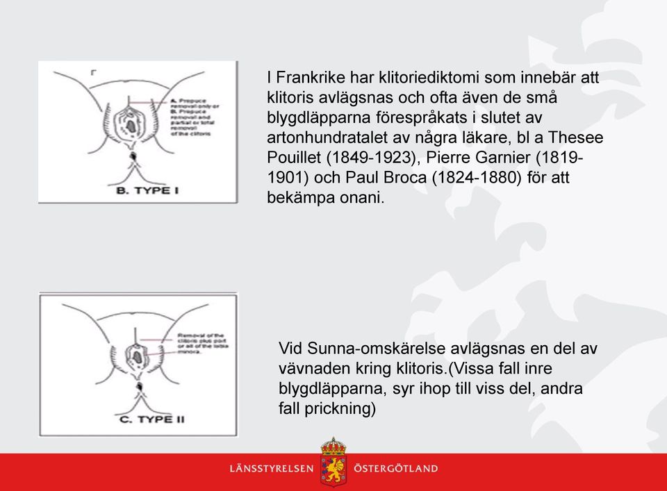 Garnier (1819-1901) och Paul Broca (1824-1880) för att bekämpa onani.