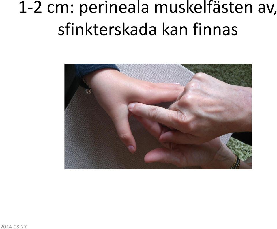 sfinkterskada kan