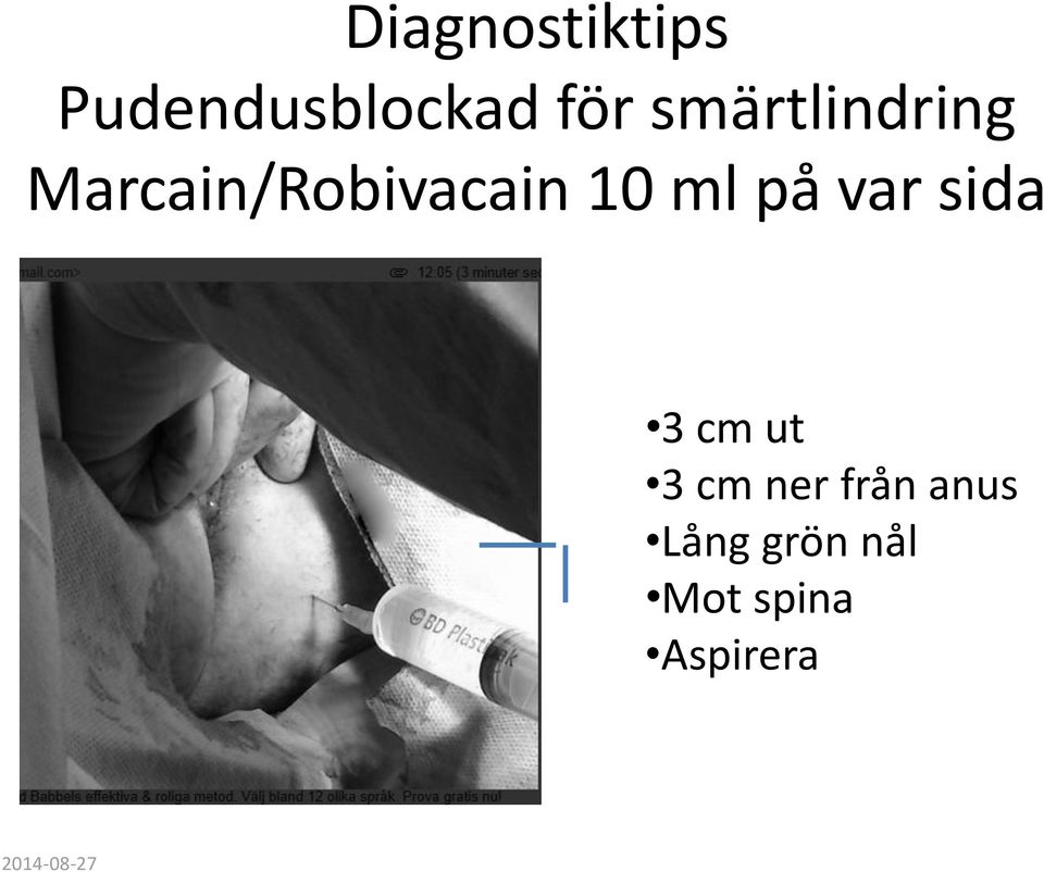 på var sida 3 cm ut 3 cm ner från anus