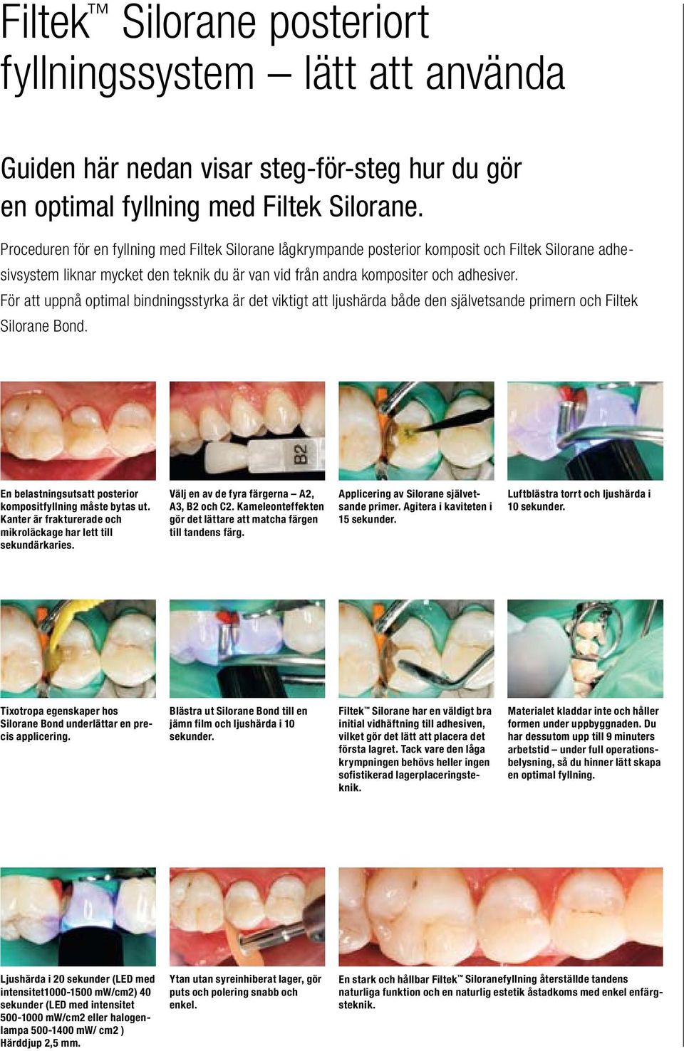 För att uppnå optimal bindningsstyrka är det viktigt att ljushärda både den självetsande primern och Filtek Silorane Bond. En belastningsutsatt posterior kompositfyllning måste bytas ut.