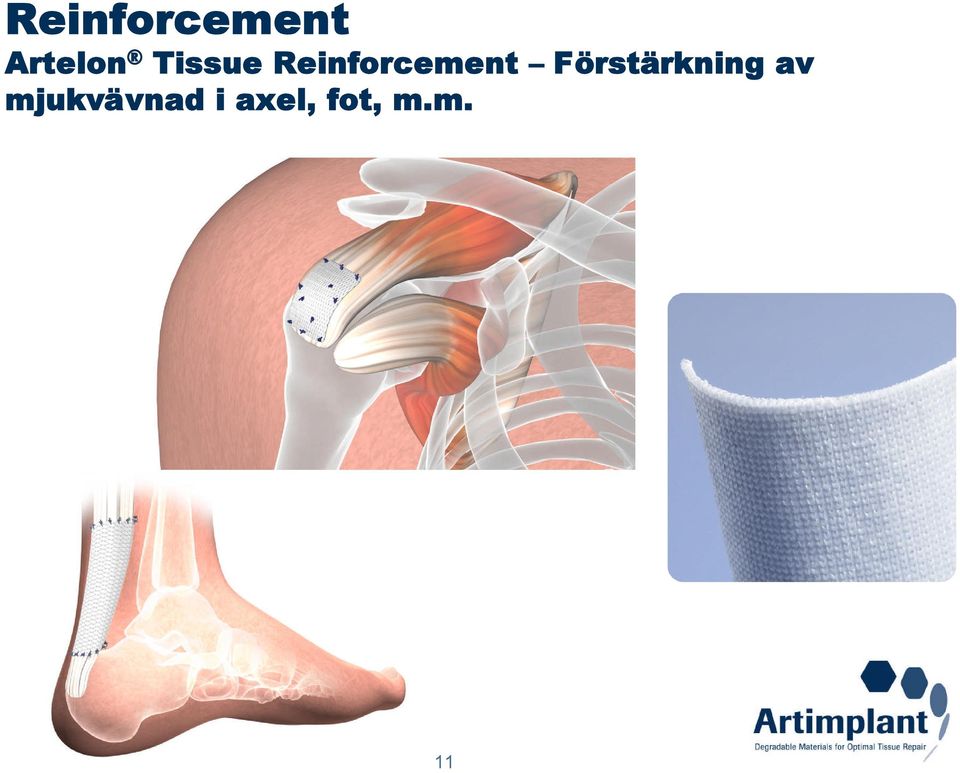 Förstärkning av