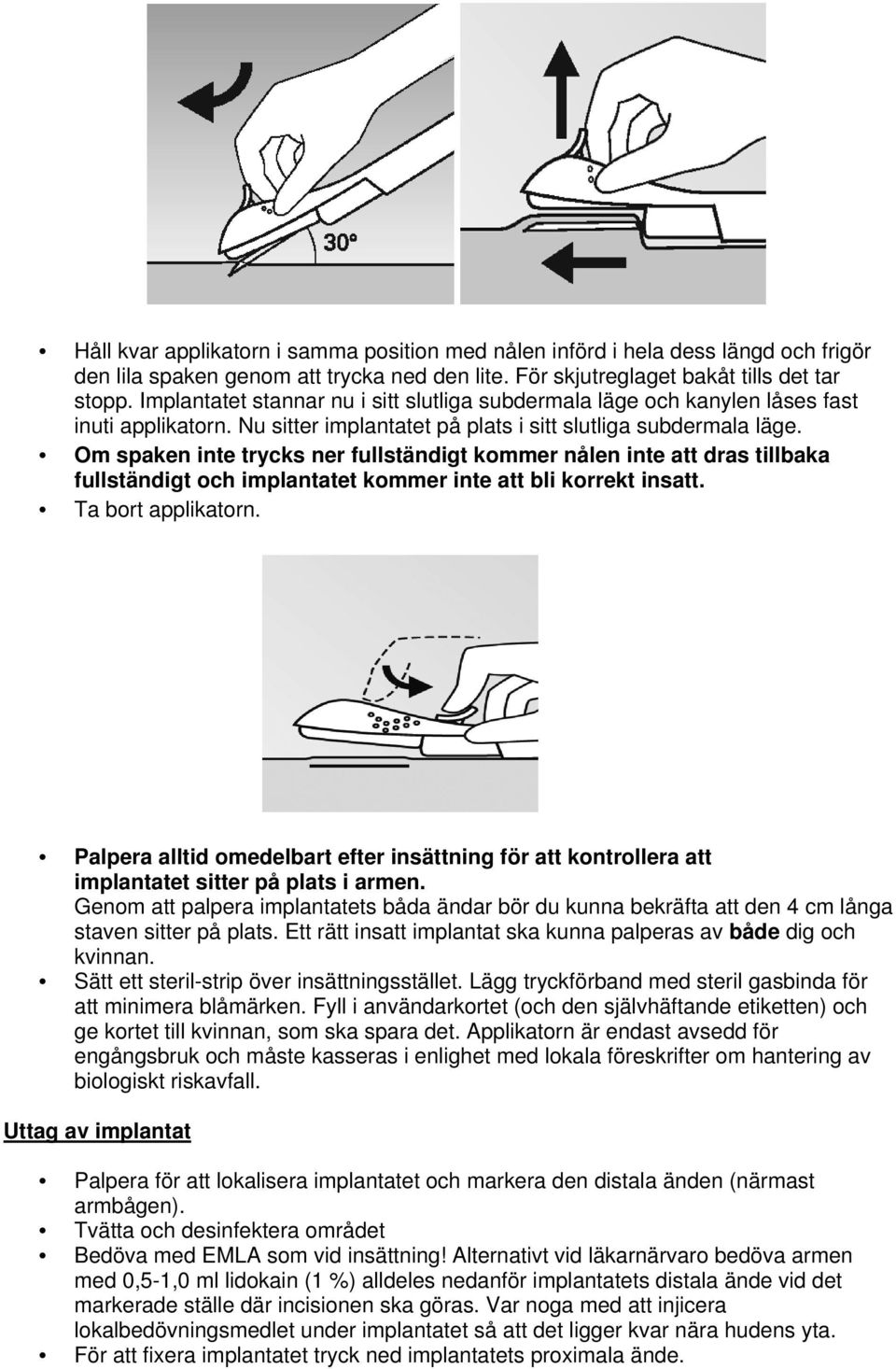 Om spaken inte trycks ner fullständigt kommer nålen inte att dras tillbaka fullständigt och implantatet kommer inte att bli korrekt insatt. Ta bort applikatorn.