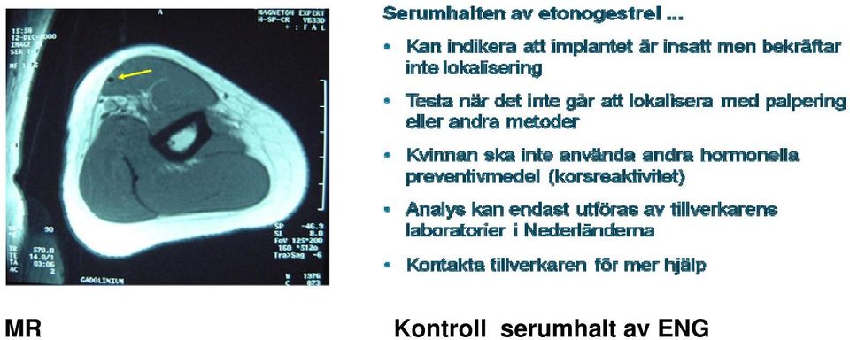 serumhalt