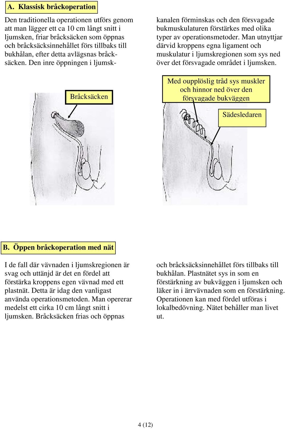 Man utnyttjar därvid kroppens egna ligament och muskulatur i ljumskregionen som sys ned över det försvagade området i ljumsken.