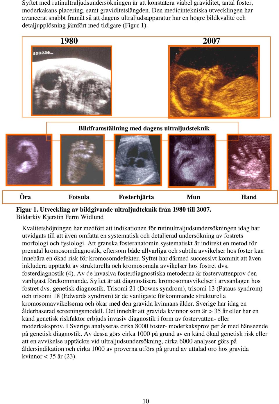 1980 2007 Bildframställning med dagens ultraljudsteknik Öra Fotsula Fosterhjärta Mun Hand Figur 1. Utveckling av bildgivande ultraljudteknik från 1980 till 2007.