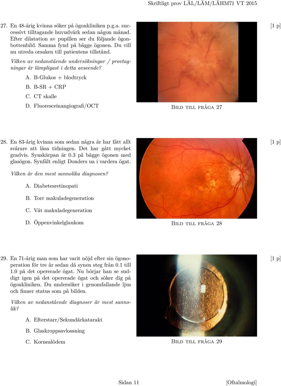 Vilken av nedanstående undersökningar / provtagningar är lämpligast i detta avseende? A. B-Glukos + blodtryck B. B-SR + CRP C. CT skalle D. Fluoresceinangiografi/OCT Bild till fråga 27 28.