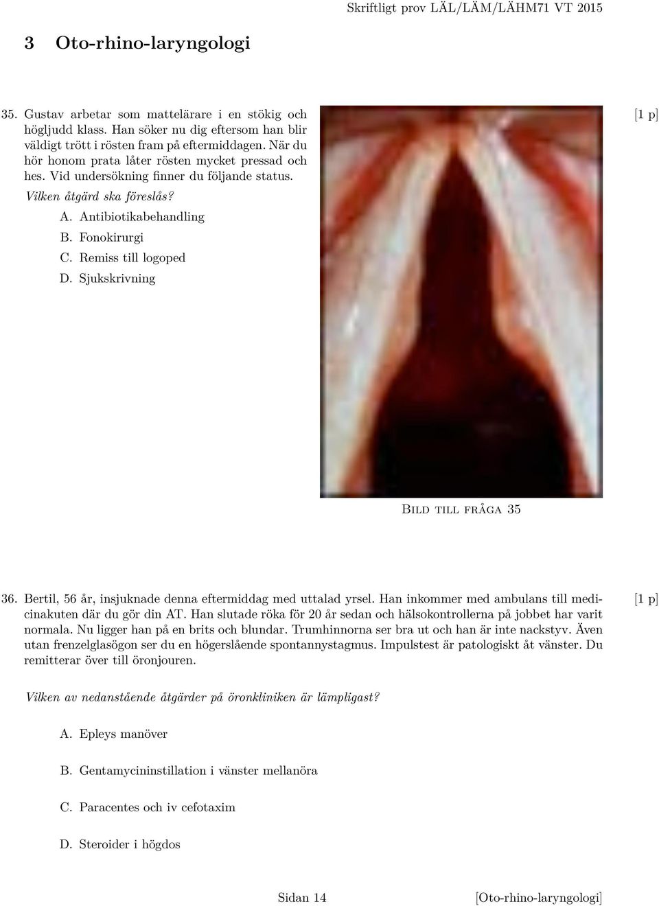 Vilken åtgärd ska föreslås? A. Antibiotikabehandling B. Fonokirurgi C. Remiss till logoped D. Sjukskrivning Bild till fråga 35 36. Bertil, 56 år, insjuknade denna eftermiddag med uttalad yrsel.