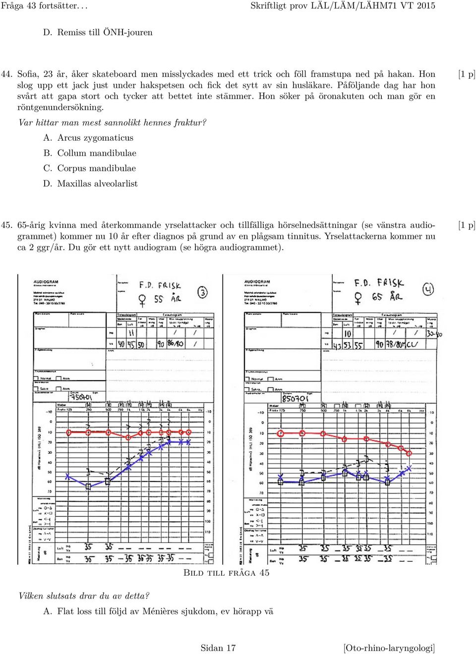 Hon söker på öronakuten och man gör en röntgenundersökning. Var hittar man mest sannolikt hennes fraktur? A. Arcus zygomaticus B. Collum mandibulae C. Corpus mandibulae D. Maxillas alveolarlist 45.