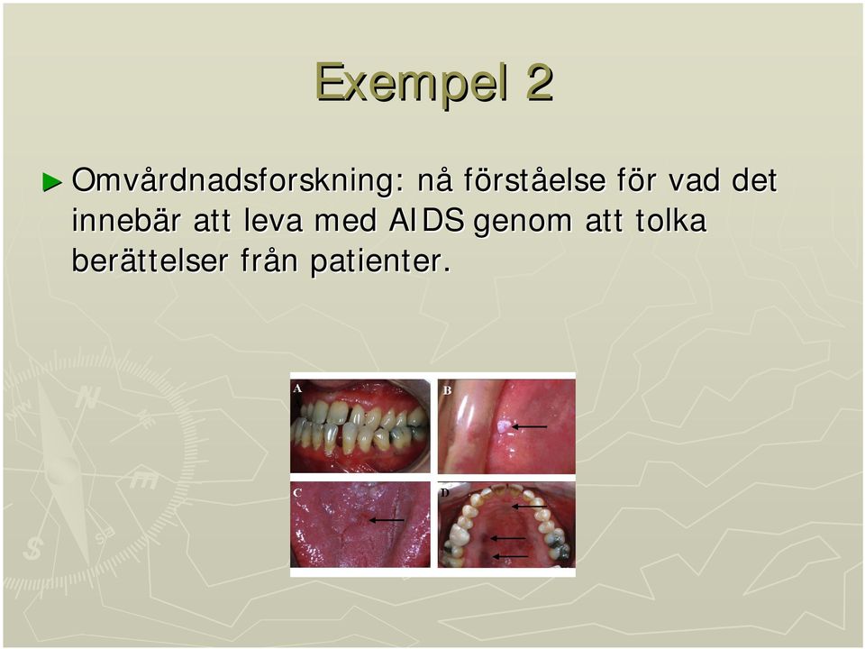 innebär r att leva med AIDS genom