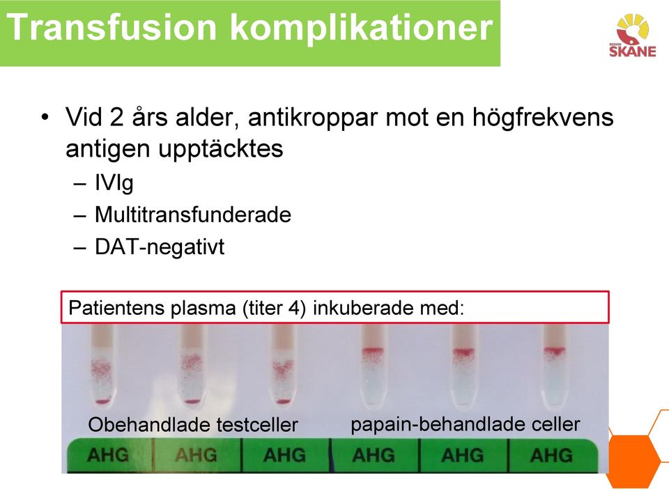 Multitransfunderade DAT-negativt Patientens plasma