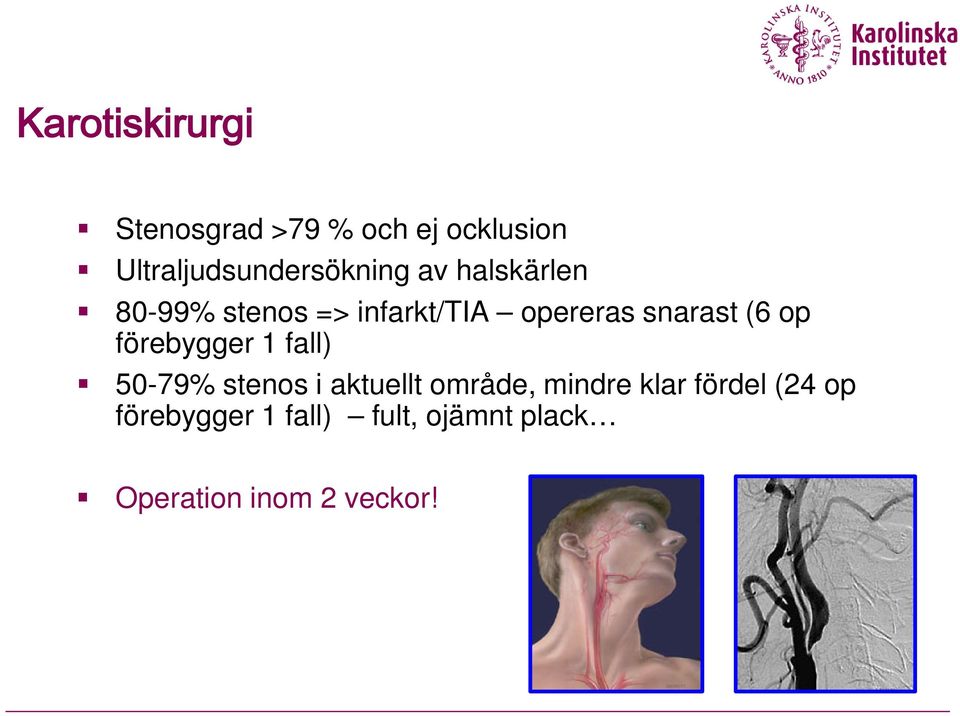 opereras snarast (6 op förebygger 1 fall) 50-79% stenos i aktuellt