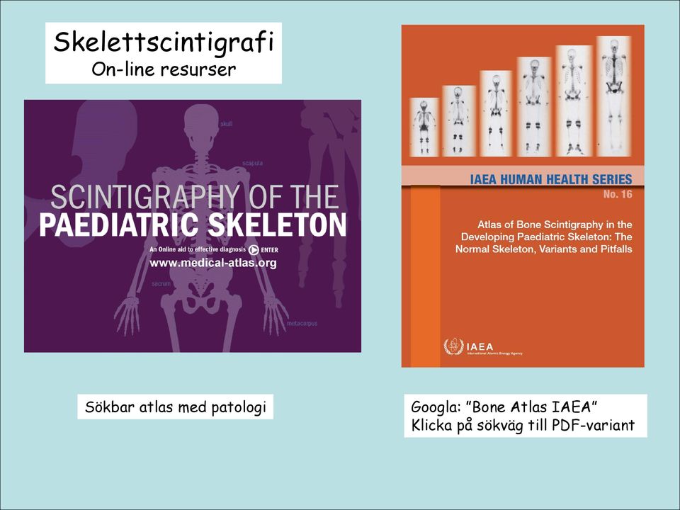 patologi Googla: Bone Atlas