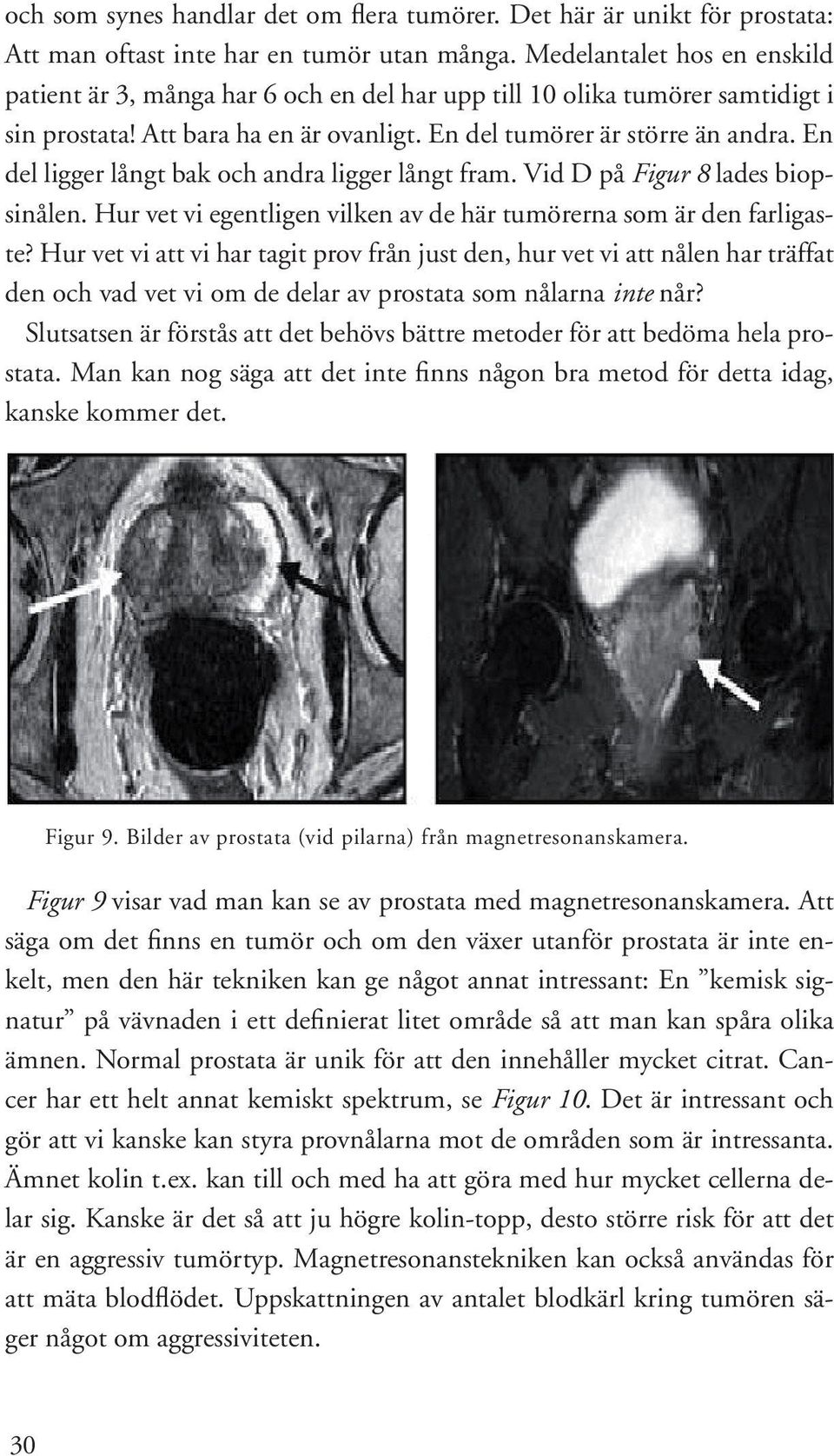 En del ligger långt bak och andra ligger långt fram. Vid D på Figur 8 lades biopsinålen. Hur vet vi egentligen vilken av de här tumörerna som är den farligaste?