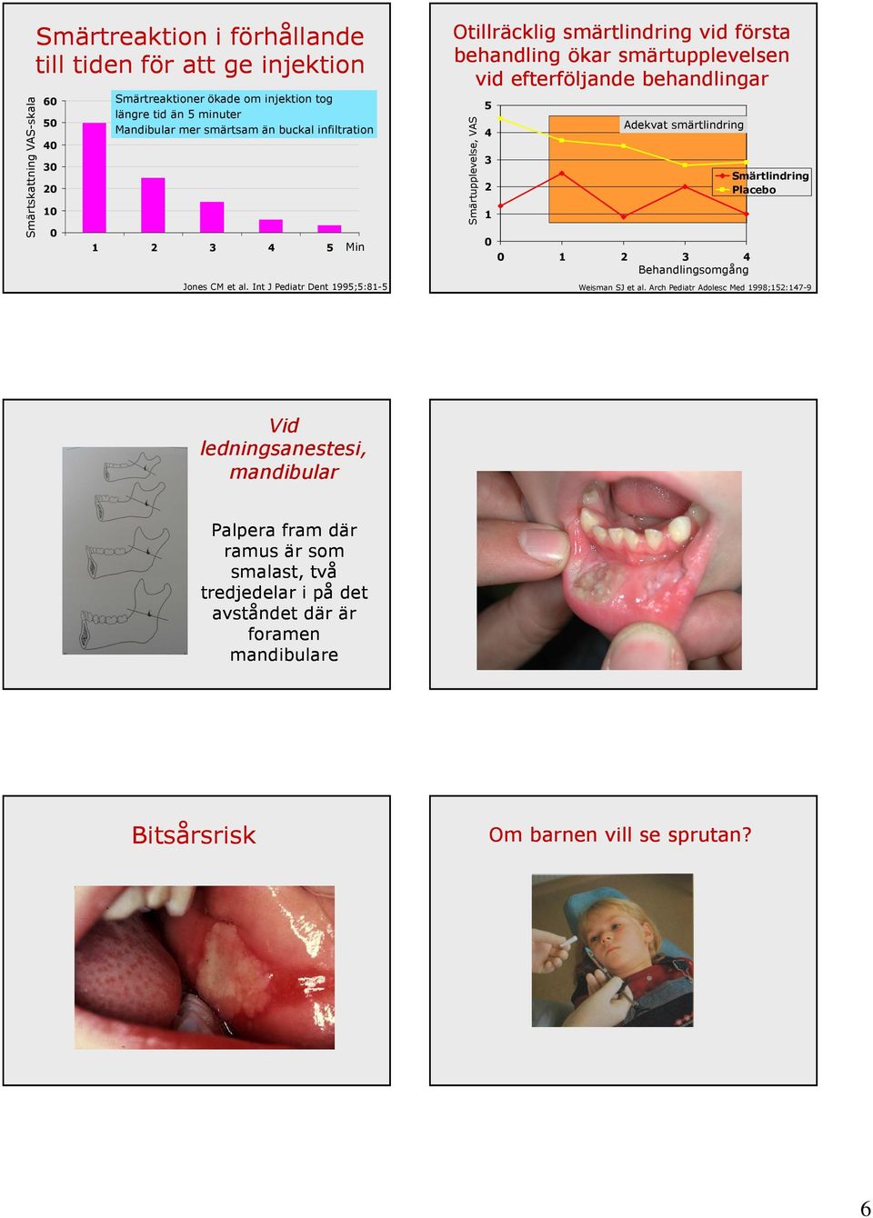 Int J Pediatr Dent 1995;5:81-5 Otillräcklig smärtlindring vid första behandling ökar smärtupplevelsen vid efterföljande behandlingar Smärtupplevelse, VAS 5 4 3 2 1 0 Adekvat