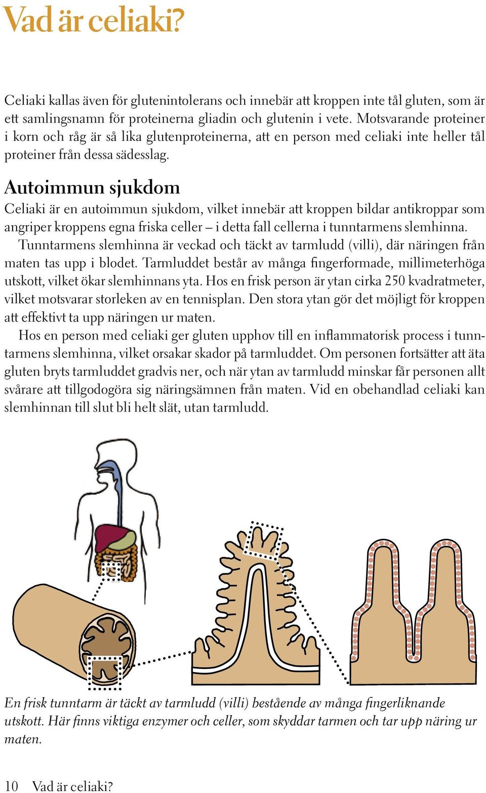 Autoimmun sjukdom Celiaki är en autoimmun sjukdom, vilket innebär att kroppen bildar antikroppar som angriper kroppens egna friska celler i detta fall cellerna i tunntarmens slemhinna.