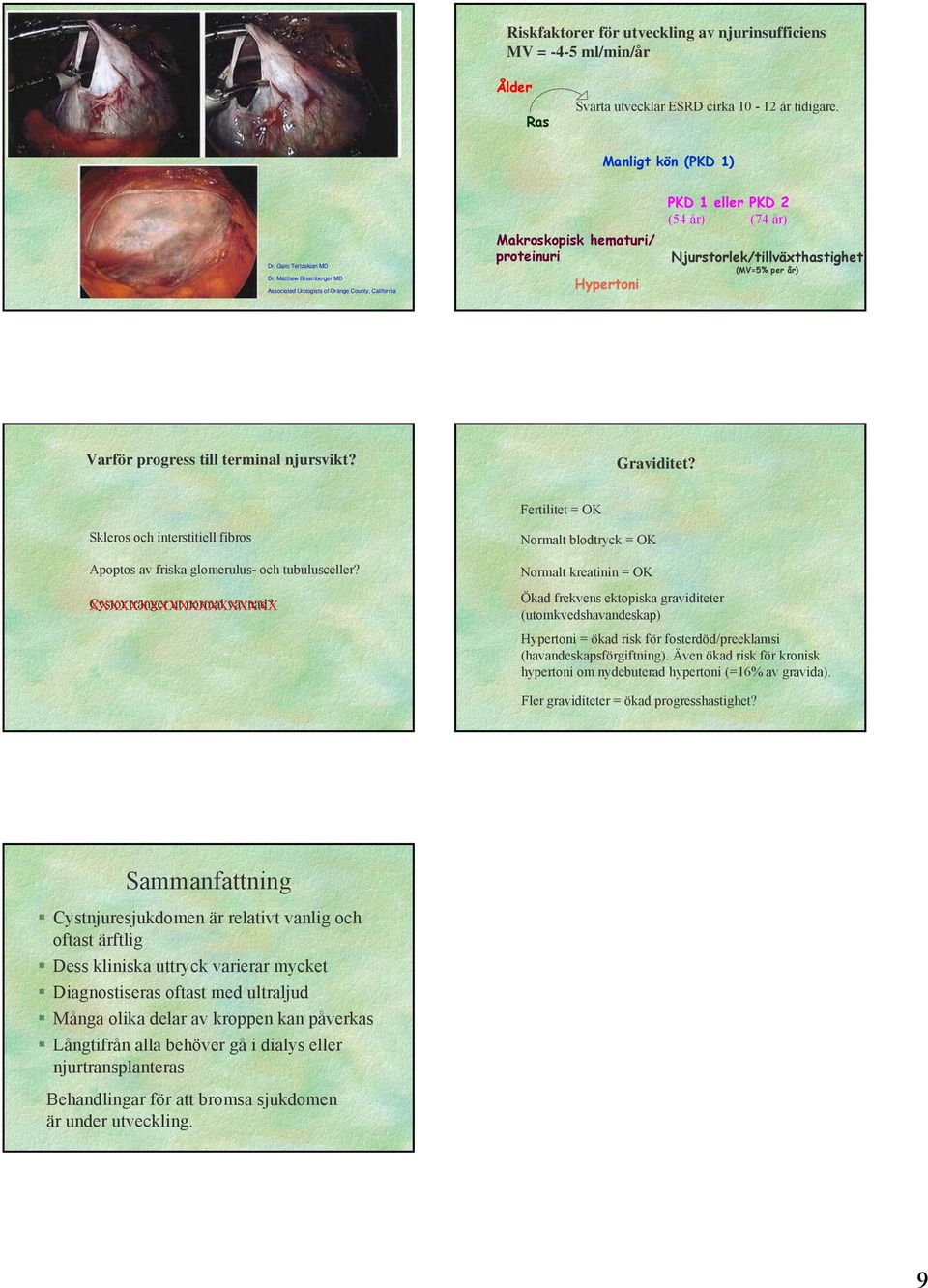 Varför progress till terminal njursvikt? Graviditet? Fertilitet = OK Skleros och interstitiell fibros Apoptos av friska glomerulus- och tubulusceller? Cystor tränger ut normal vävnad?