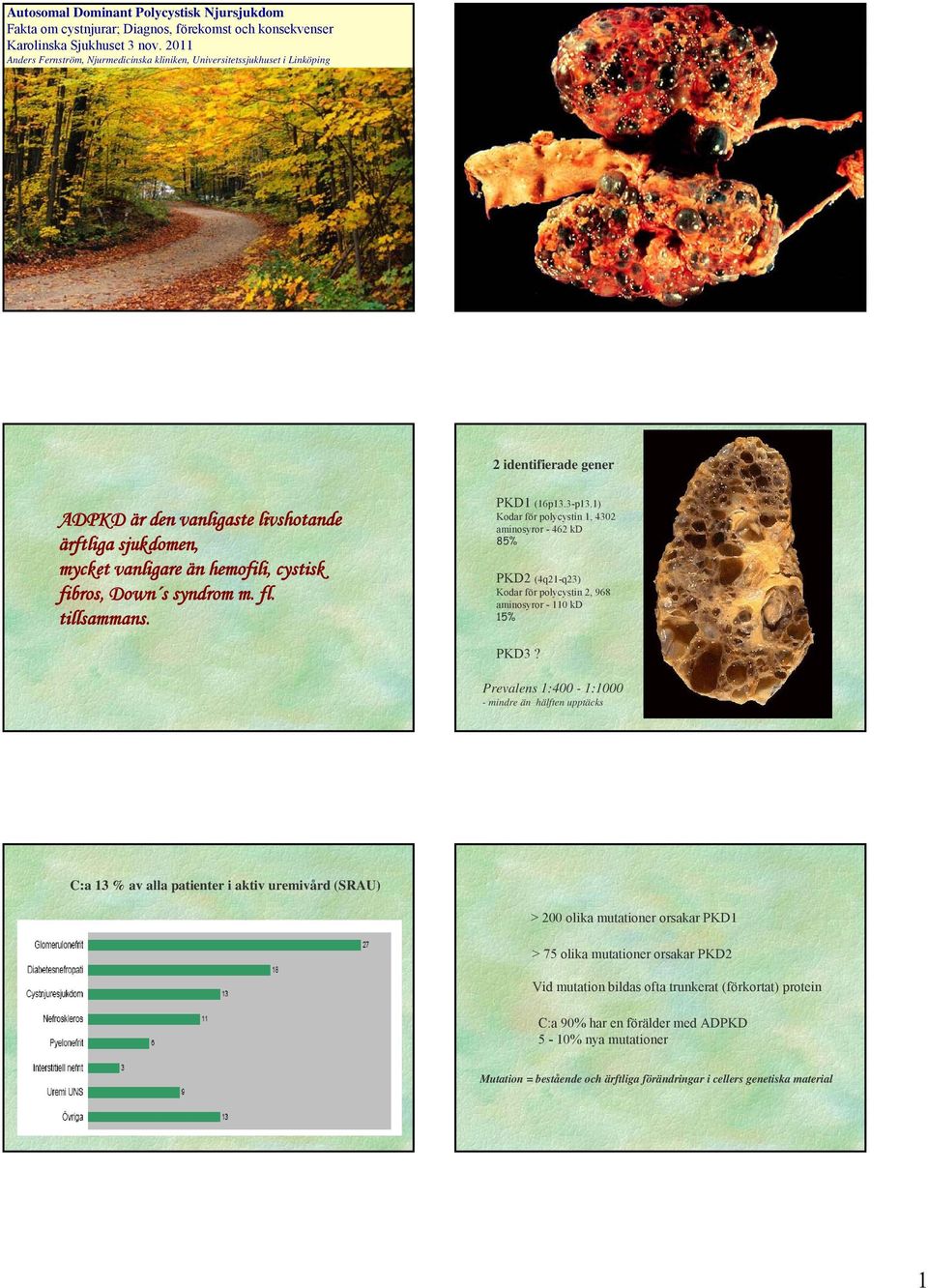 fibros, Down s syndrom m. fl. tillsammans. PKD1 (16p13.3-p13.1) Kodar för polycystin 1, 4302 aminosyror - 462 kd 85% PKD2 (4q21-q23) Kodar för polycystin 2, 968 aminosyror - 110 kd 15% PKD3?