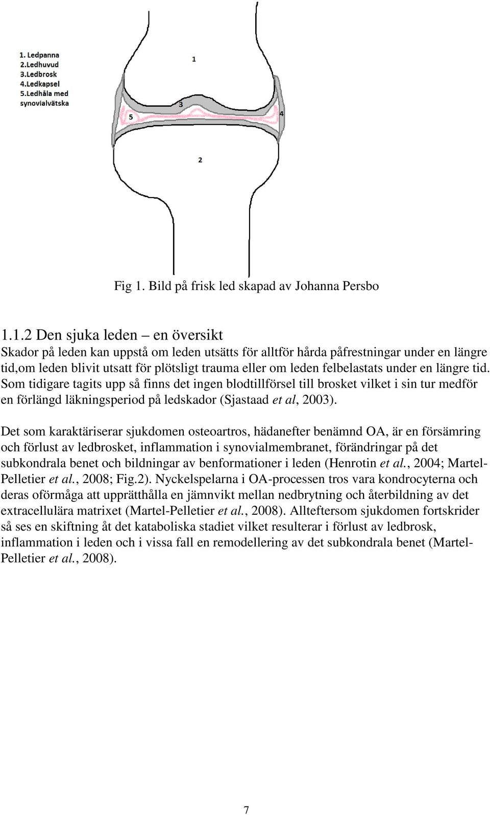 1.2 Den sjuka leden en översikt Skador på leden kan uppstå om leden utsätts för alltför hårda påfrestningar under en längre tid,om leden blivit utsatt för plötsligt trauma eller om leden felbelastats