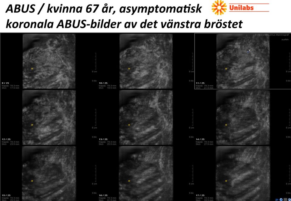 ABUS- bilder av det