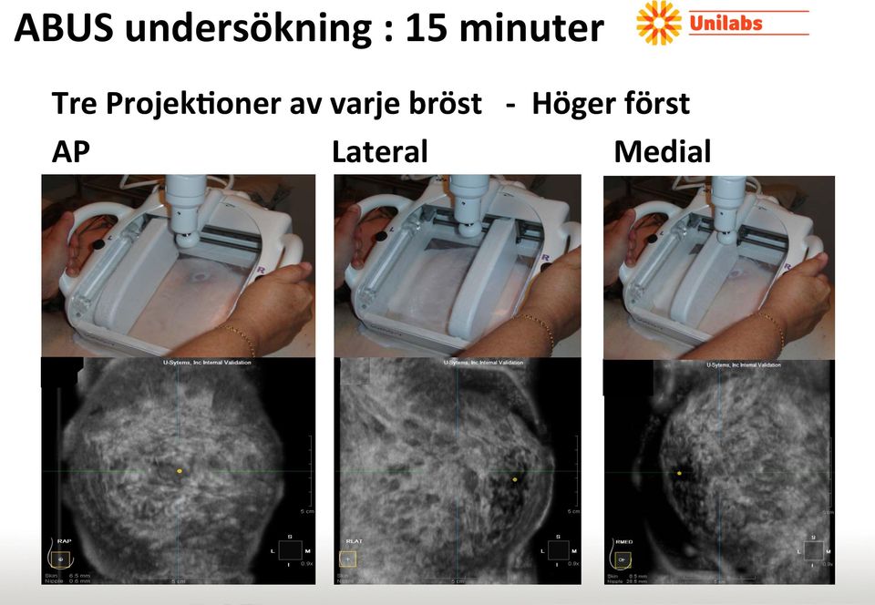 varje bröst - Höger först