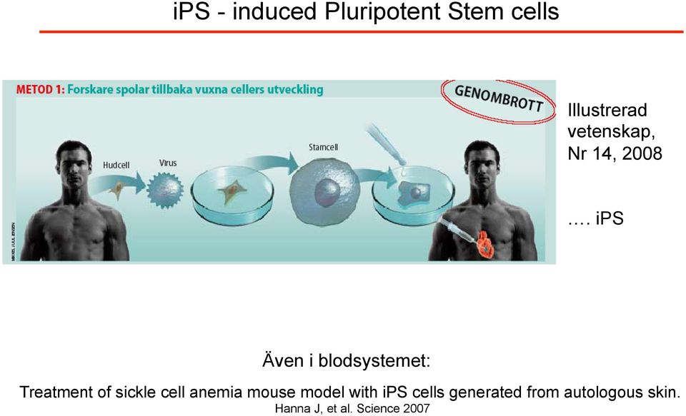 ips Även i blodsystemet: Treatment of sickle cell