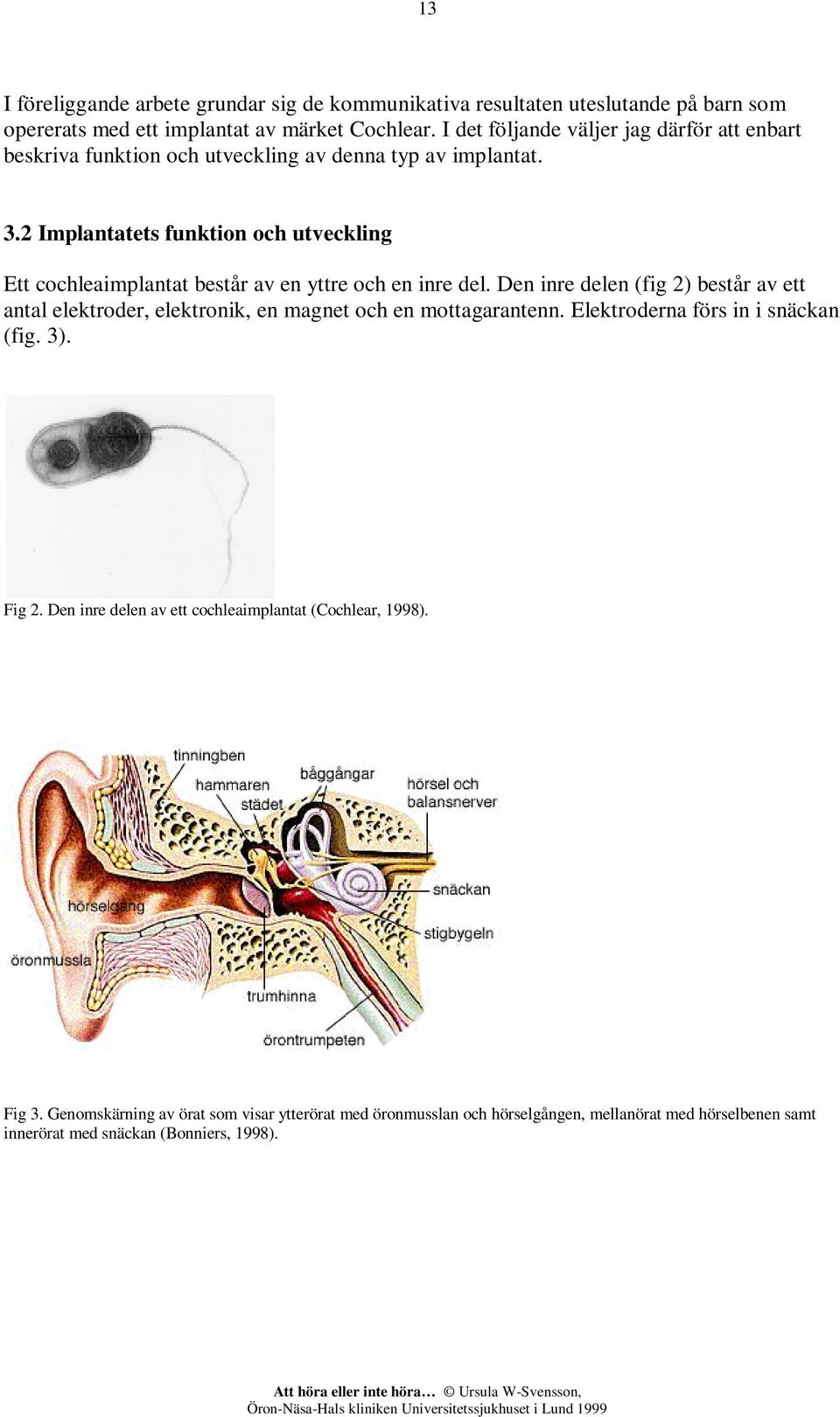 2 Implantatets funktion och utveckling Ett cochleaimplantat består av en yttre och en inre del.