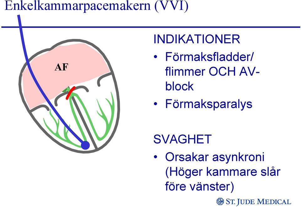 OCH AVblock Förmaksparalys SVAGHET