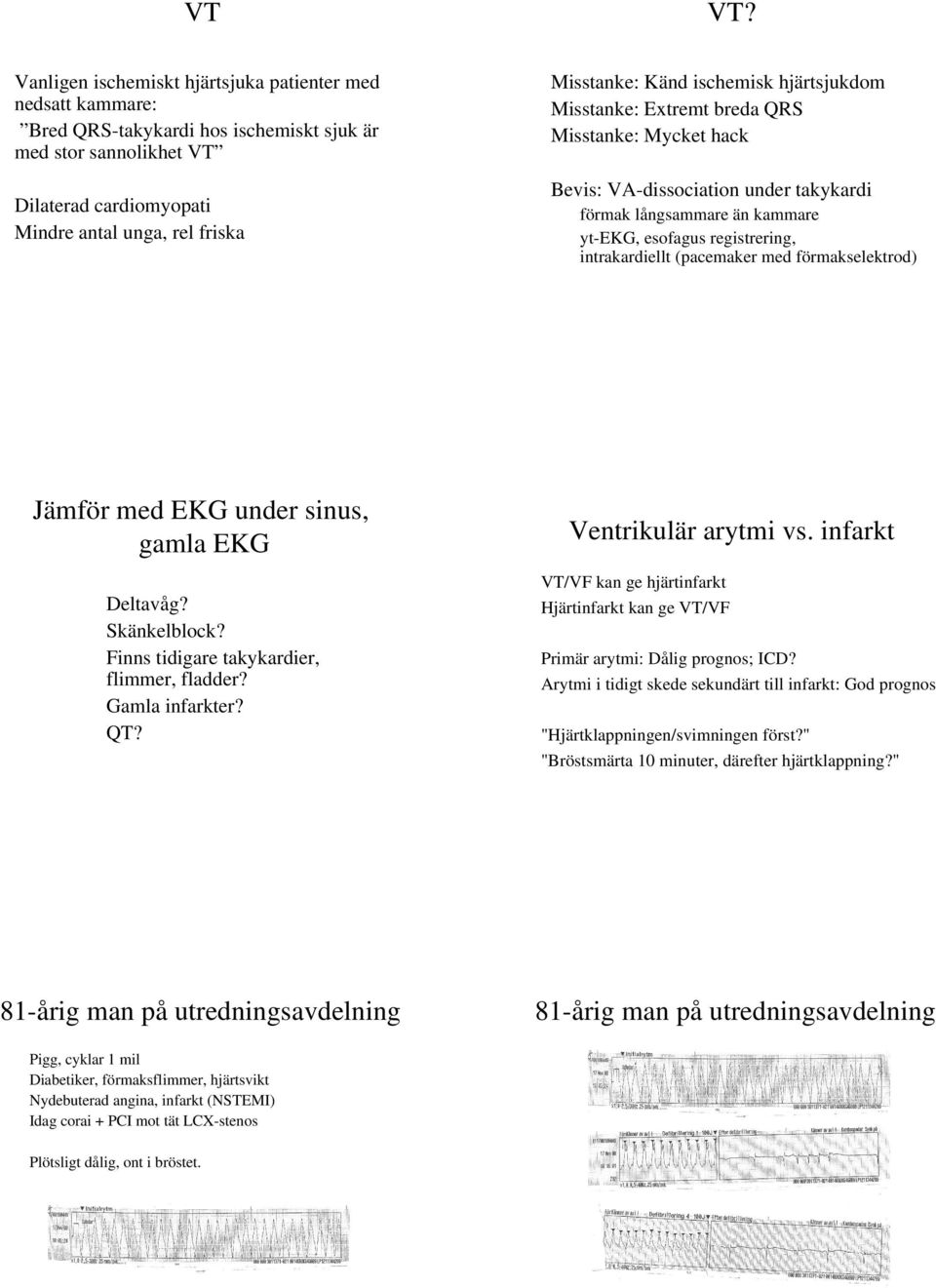 antal unga, rel friska förmak långsammare än kammare yt-ekg, esofagus registrering, intrakardiellt (pacemaker med förmakselektrod) Jämför med EKG under sinus, gamla EKG Ventrikulär arytmi vs.