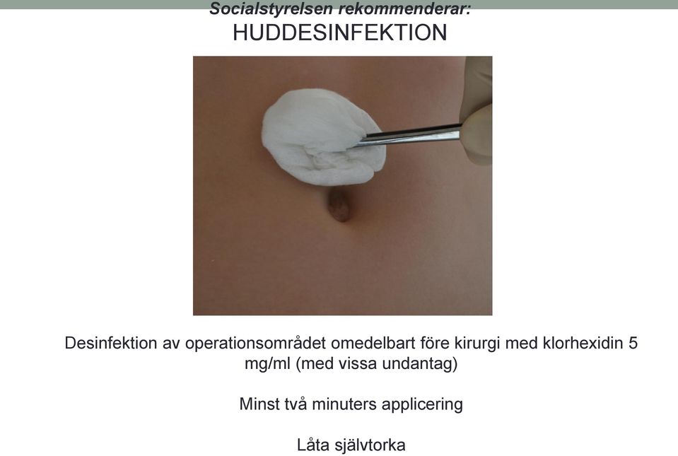 före kirurgi med klorhexidin 5 mg/ml (med vissa