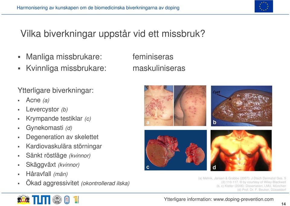 testiklar (c) Gynekomasti (d) Degeneration av skelettet Kardiovaskulära störningar Sänkt röstläge (kvinnor) Skäggväxt (kvinnor) Håravfall