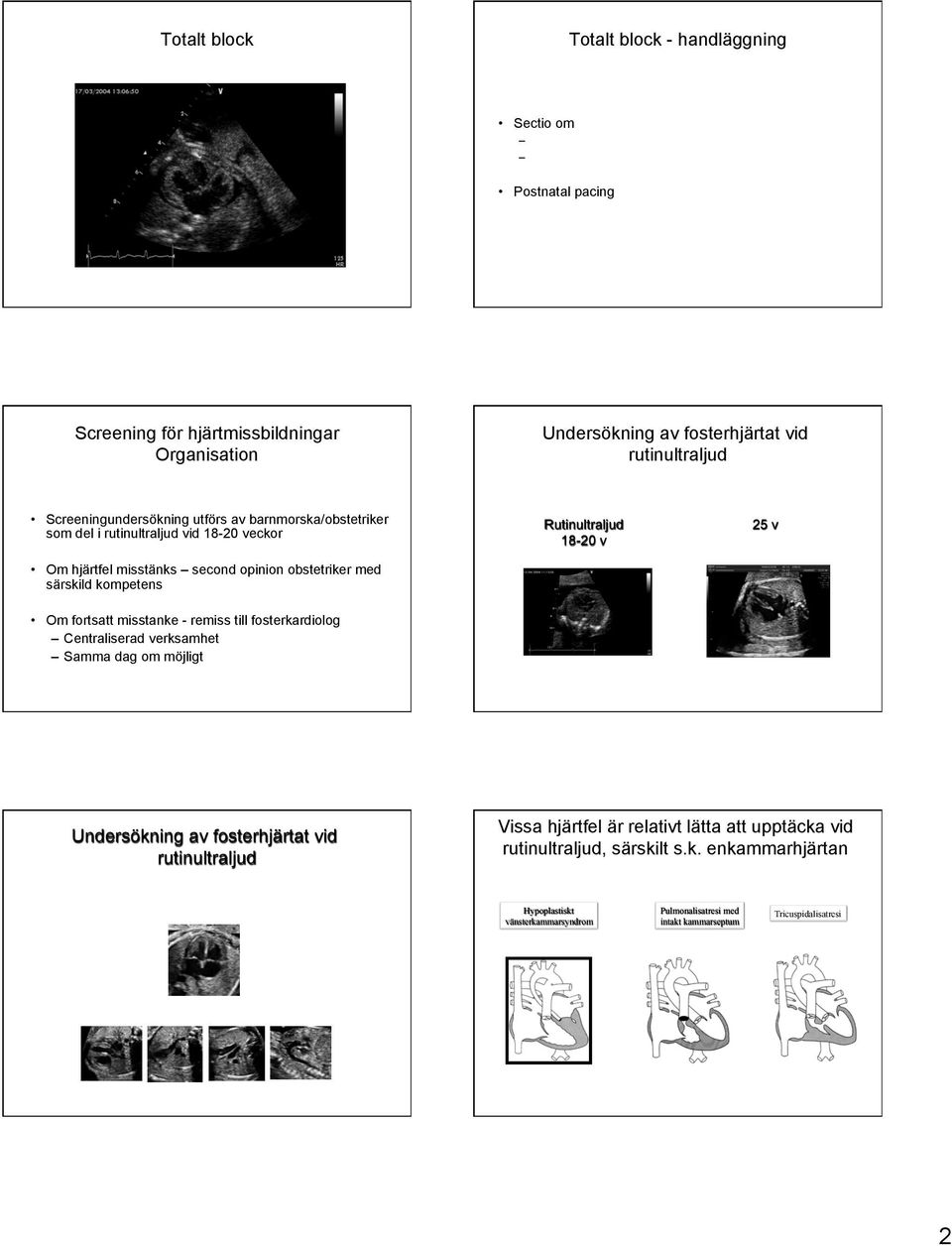 kompetens Rutinultraljud 18-20 v 25 v Om fortsatt misstanke - remiss till fosterkardiolog Centraliserad verksamhet Samma dag om möjligt Undersökning av fosterhjärtat vid rutinultraljud