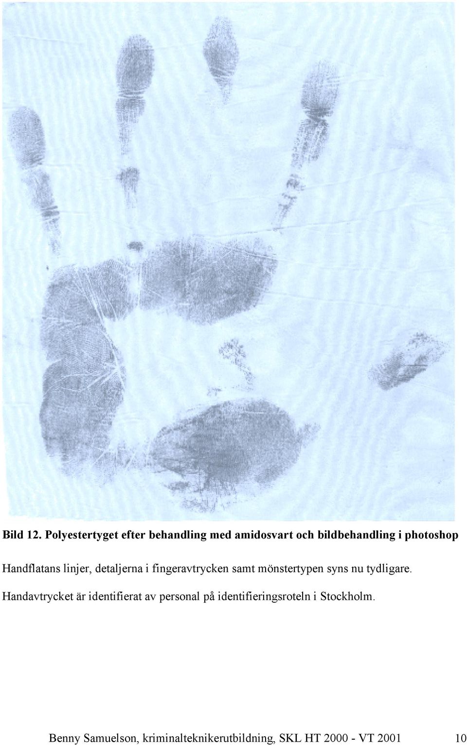 Handflatans linjer, detaljerna i fingeravtrycken samt mönstertypen syns nu