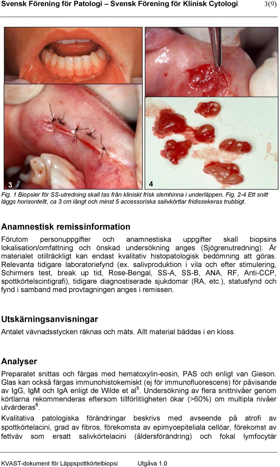 Är materialet otillräckligt kan endast kvalitativ histopatologisk bedömning att göras. Relevanta tidigare laboratoriefynd (ex.