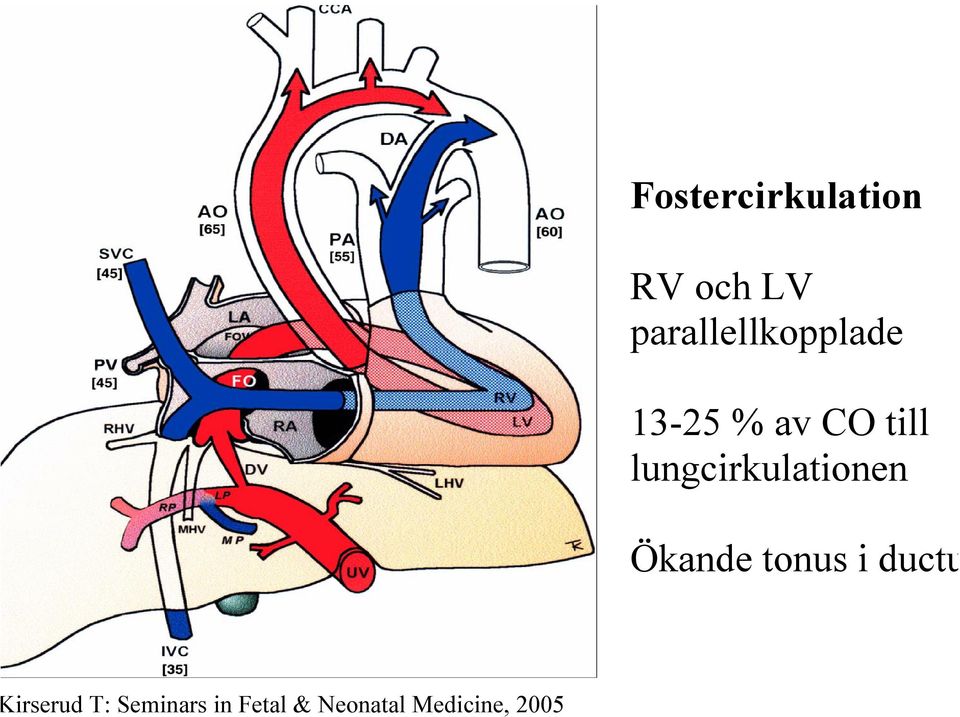 lungcirkulationen Ökande tonus i ductus