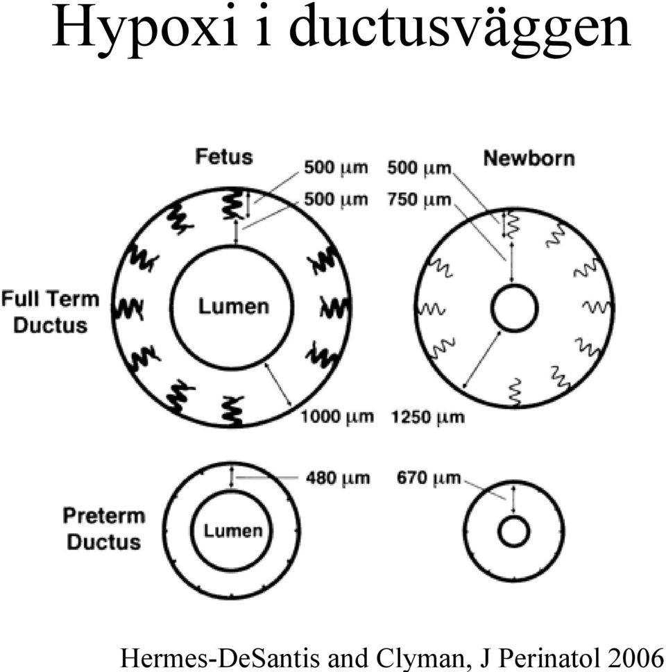 Hermes-DeSantis