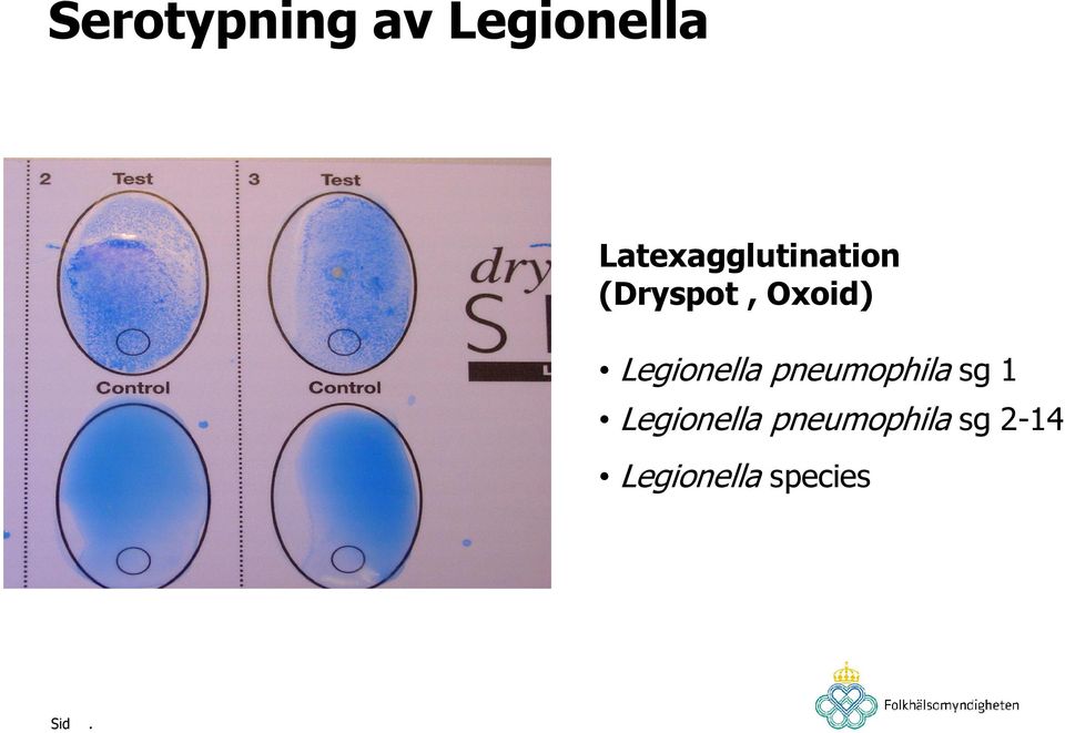 Legionella pneumophila sg 1