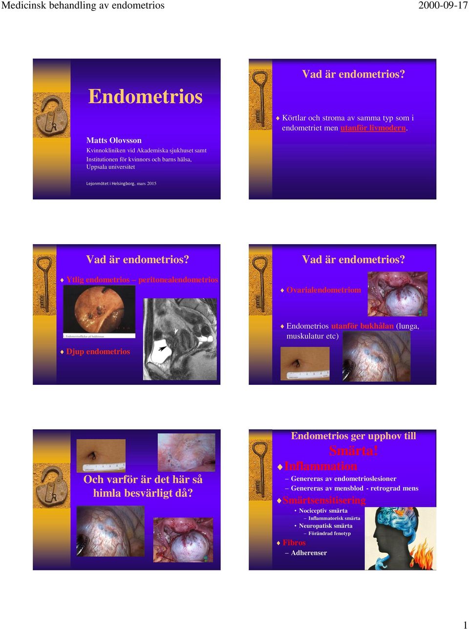 Ytlig endometrios peritonealendometrios Vad är endometrios?