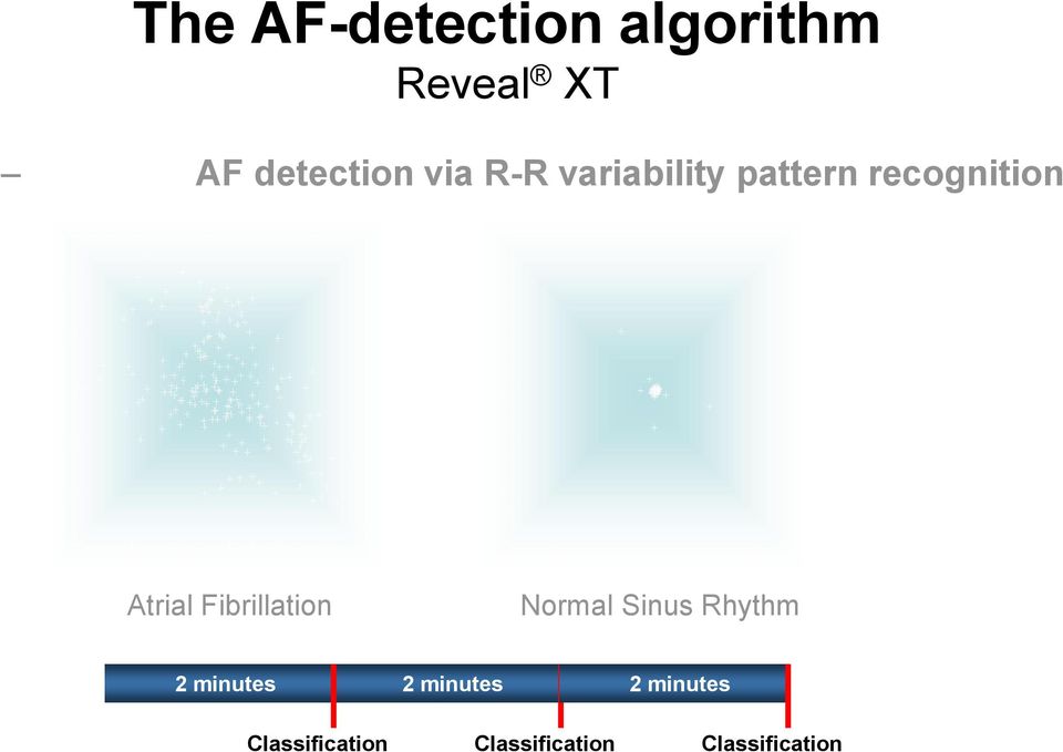 Fibrillation Normal Sinus Rhythm 2 minutes 2