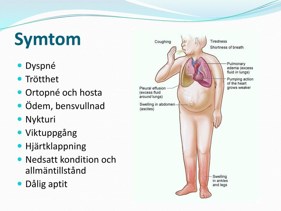 Viktuppgång Hjärtklappning Nedsatt