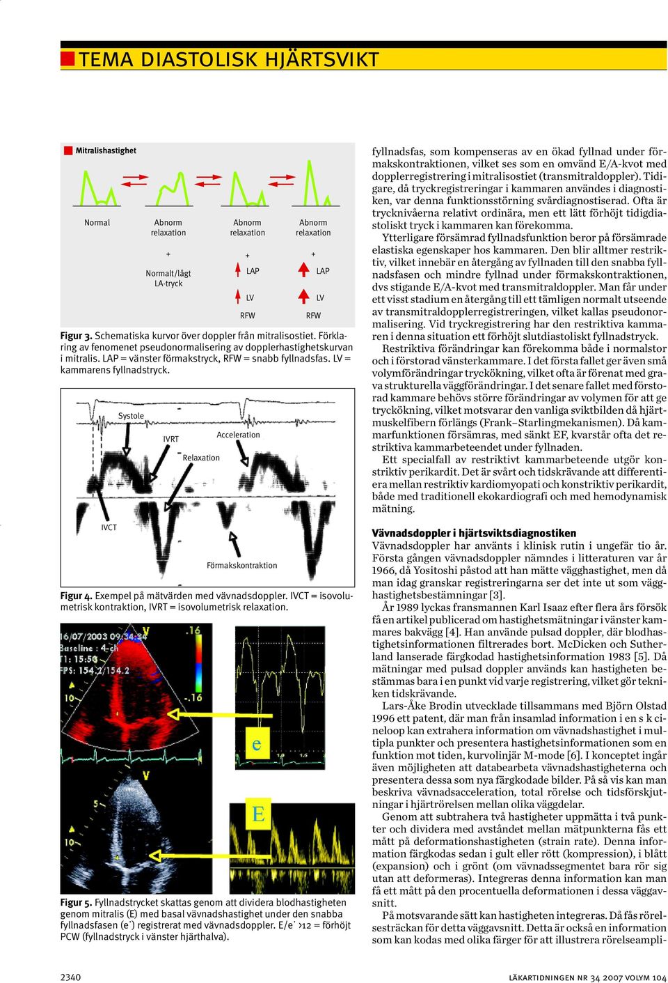 Exempel på mätvärden med vävnadsdoppler. IVCT = isovolumetrisk kontraktion, IVRT = isovolumetrisk relaxation. Figur 5.