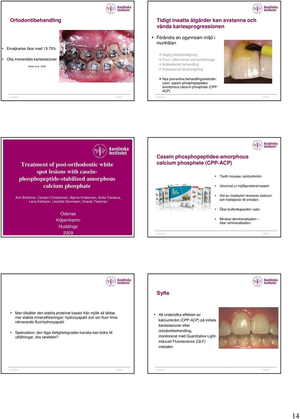 Professionell tandrengöring Nya preventiva behandlingsmetoder: ozon, casein phosphopeptidesamorphous calcium phosphate (CPP- ACP) Treatment of post-orthodontic white spot lesions with