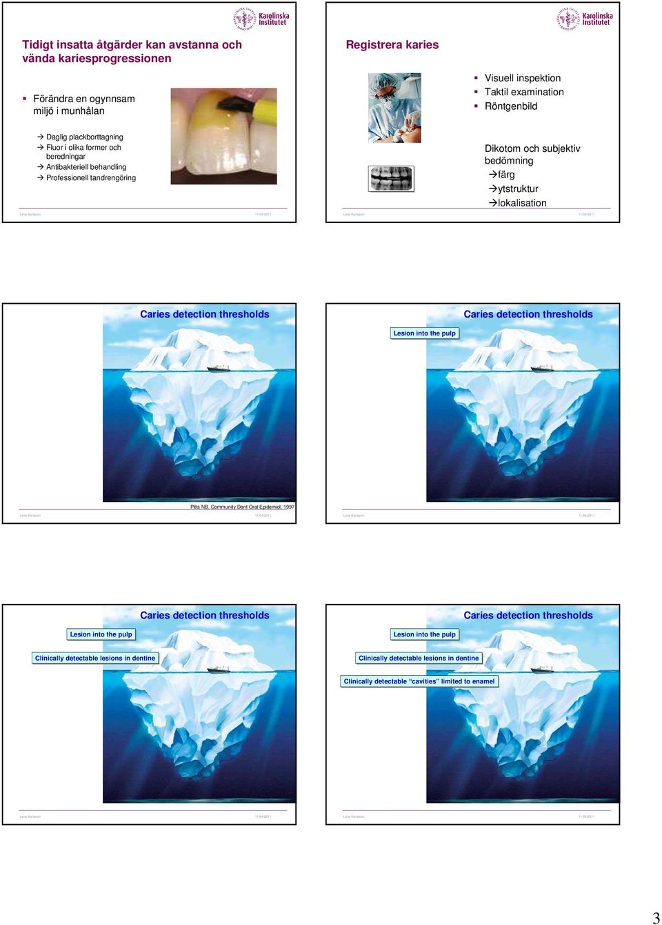 Caries detection thresholds Caries detection thresholds Lesion into the pulp Pitts NB. Community Dent Oral Epidemiol.