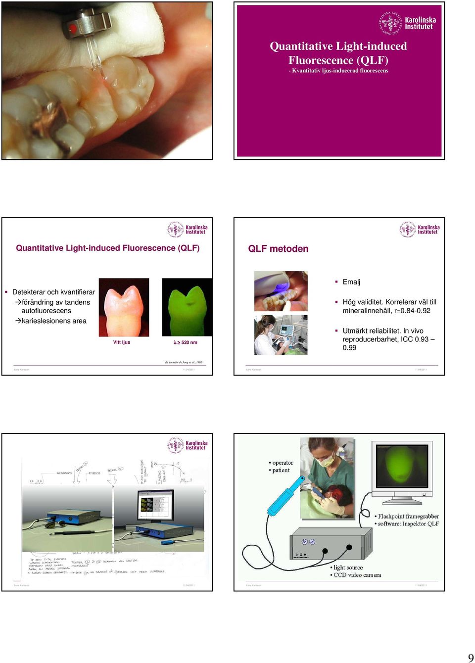autofluorescens karieslesionens area Vitt ljus λ 520 nm Emalj Hög validitet.