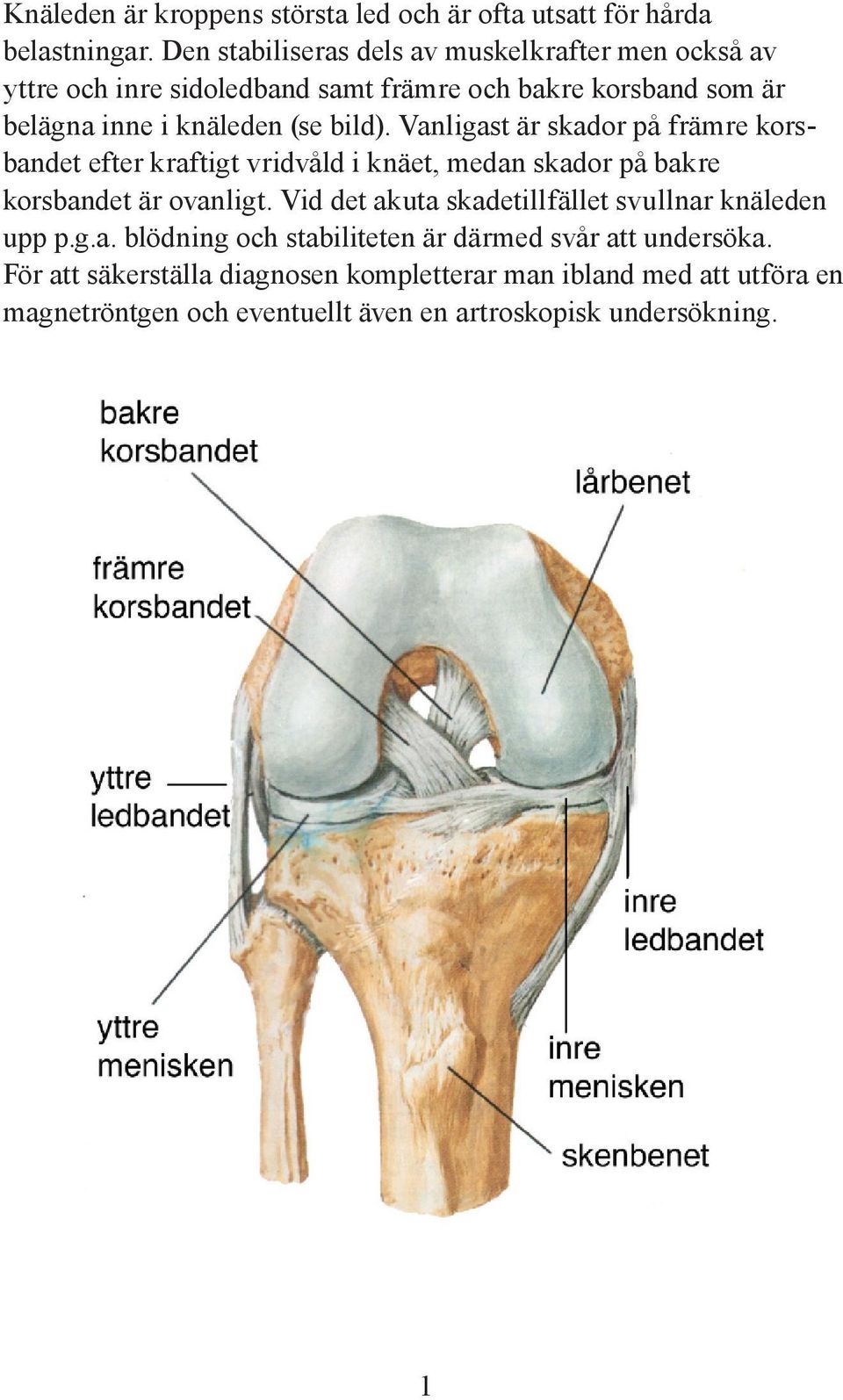 bild). Vanligast är skador på främre korsbandet efter kraftigt vridvåld i knäet, medan skador på bakre korsbandet är ovanligt.