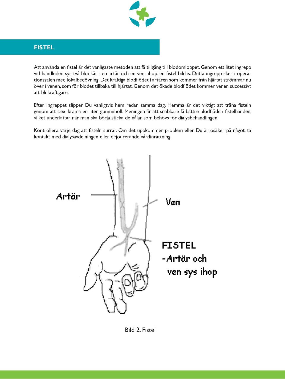Genom det ökade blodflödet kommer venen successivt att bli kraftigare. Efter ingreppet slipper Du vanligtvis hem redan samma dag. Hemma är det viktigt att träna fisteln genom att t.ex.