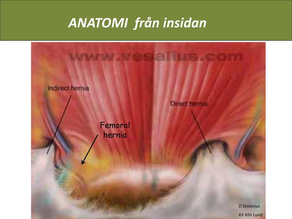 insidan